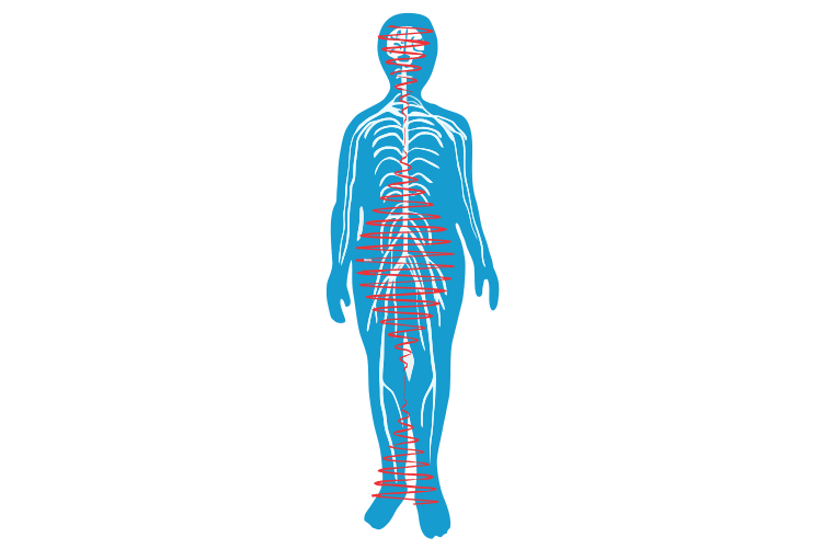 Physics of Pain